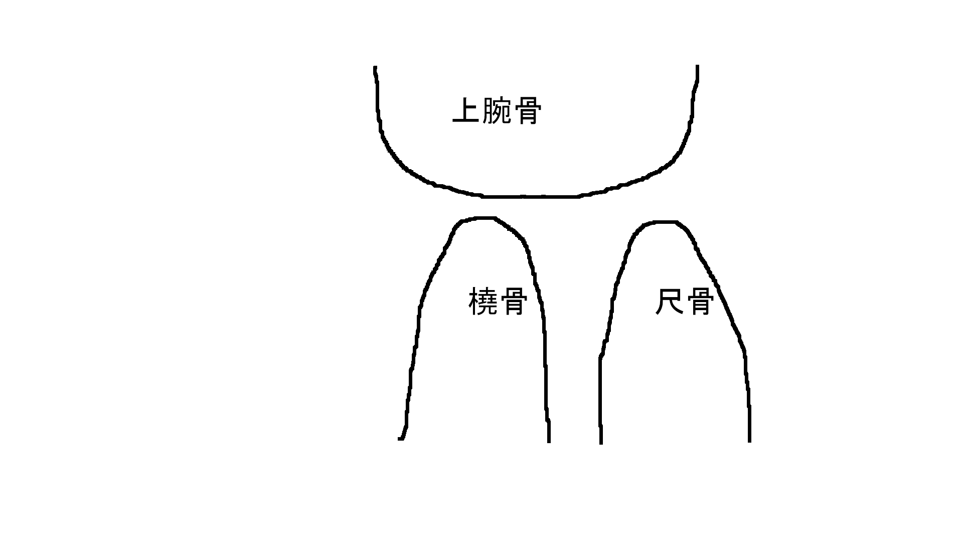 事例